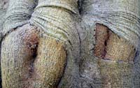 AN